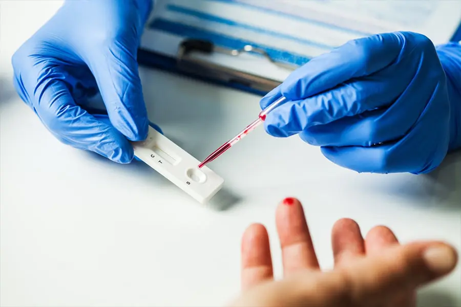 prosedur rapid test