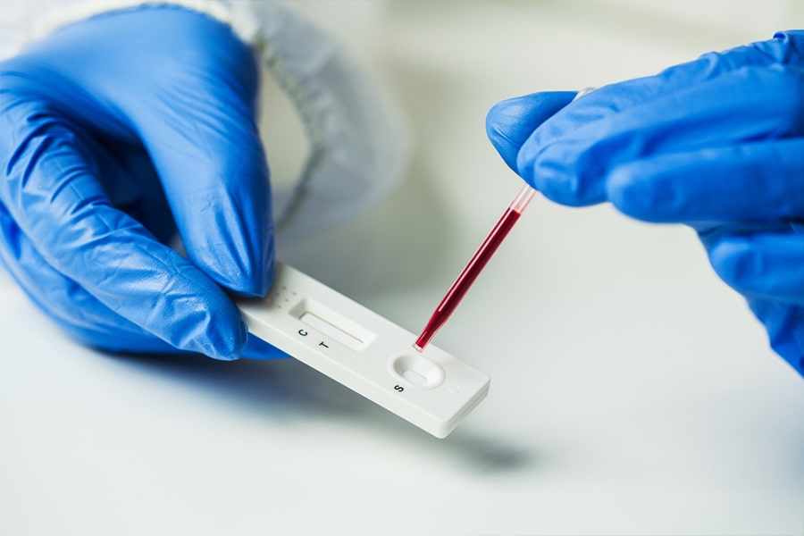 prosedur rapid test